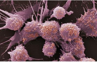 肿瘤转移怎么办?收集血液癌细胞的技术诞生