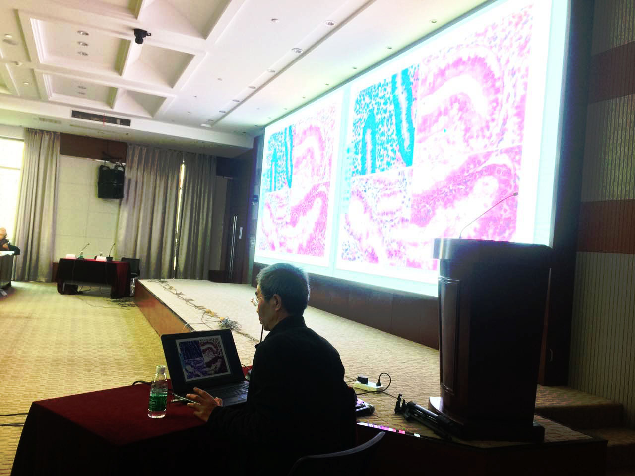 周先荣教授讲解子宫内膜组织病理学