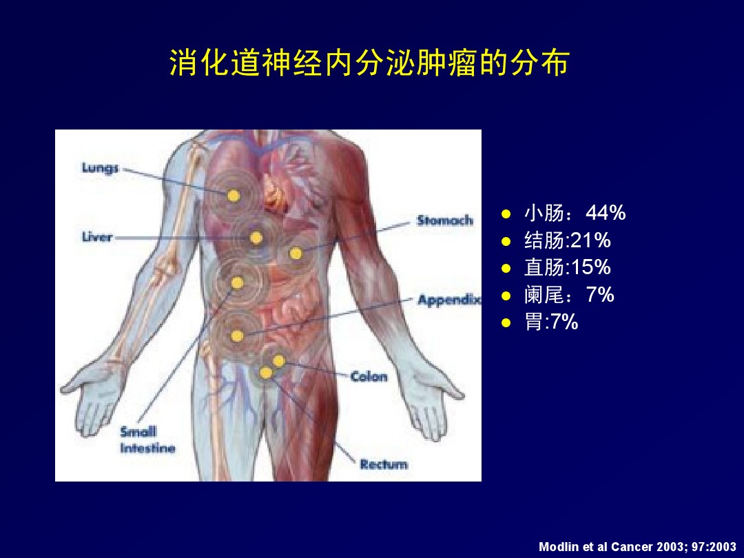 胃肠胰腺神经内分泌癌肿瘤的病理学诊断
