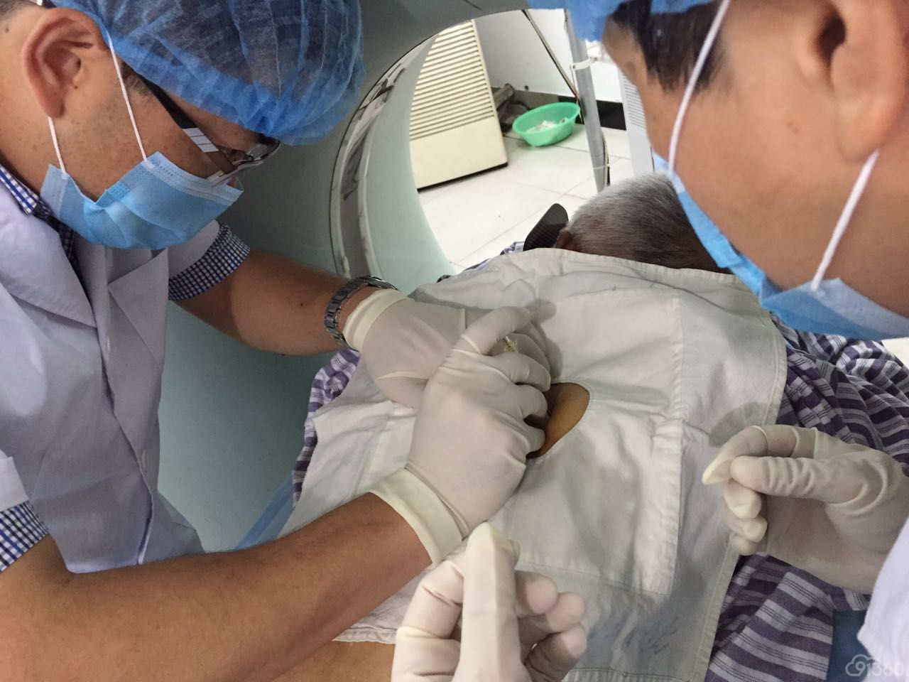 肺癌穿刺次没成功,还要再做一次,可不可以,有什么