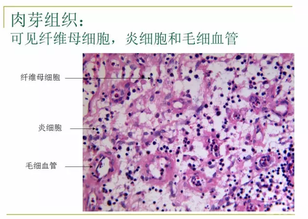 病理学切片观察