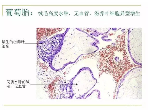 病理学切片观察