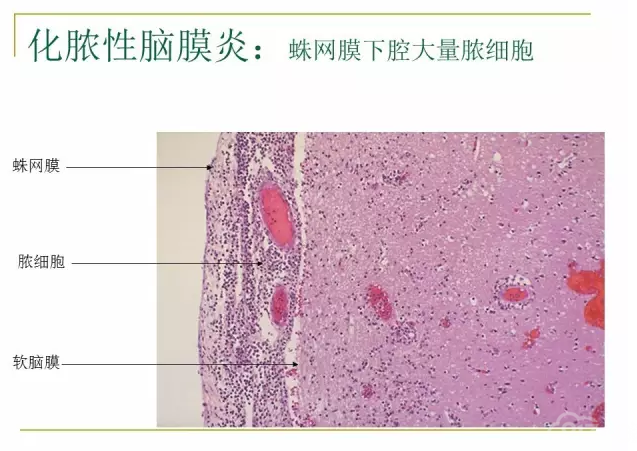 病理学切片观察