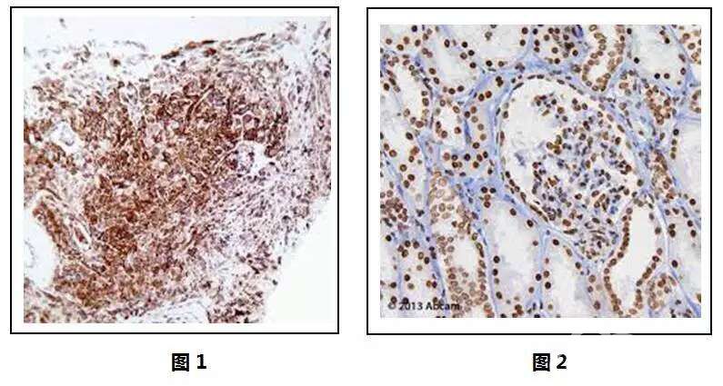 一文读懂 | 免疫组化步骤,结果分析及注意事项
