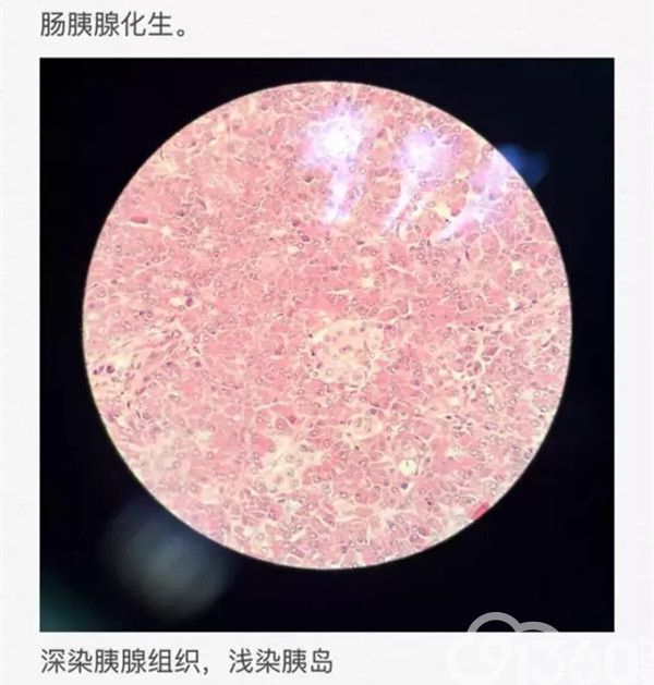 消化道病理切片图