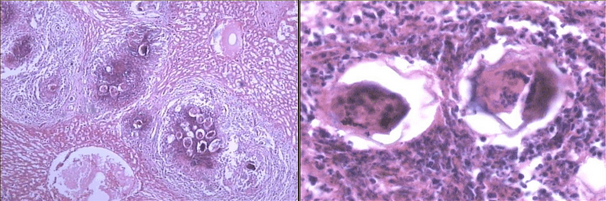 病理实验切片图片整理第一部分