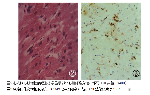 2017年11月26日 - 患混合 结缔组织病能买商业 保险吗 患混合 结缔组