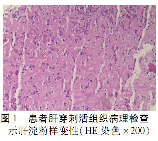 55岁男性患肝淀粉样变入院治疗病例分析