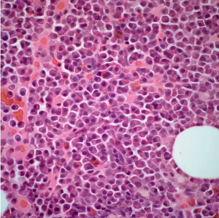浆细胞图片显微镜图片