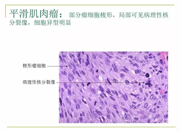 病理學切片觀察