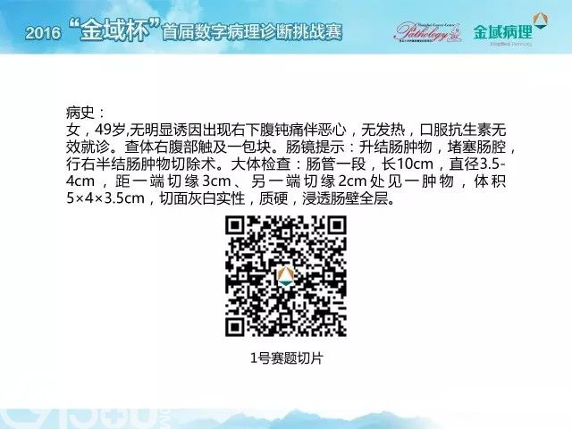 “为真相而战”2016金域杯首届数字病理诊断挑战赛全国六强出炉
