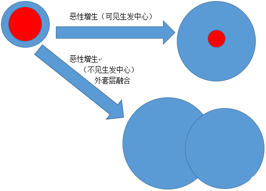 淋巴结生发中心图片