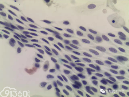 化生细胞 细胞中的骡子 91360智慧病理网