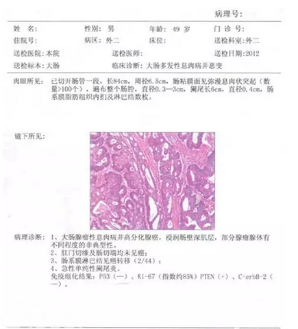病理报告示例