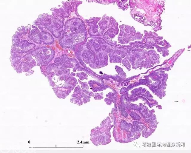 膀胱组织切片结构图片