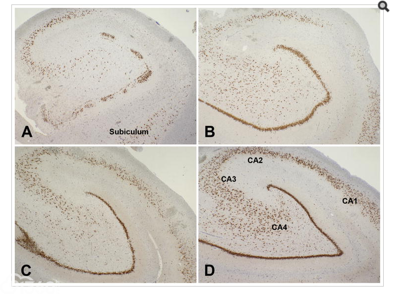 Surgical pathology of epilepsy-associated non-neoplastic cerebral lesions: a brief introduction with special reference to hippocampal sclerosis and focal cortical dysplasia